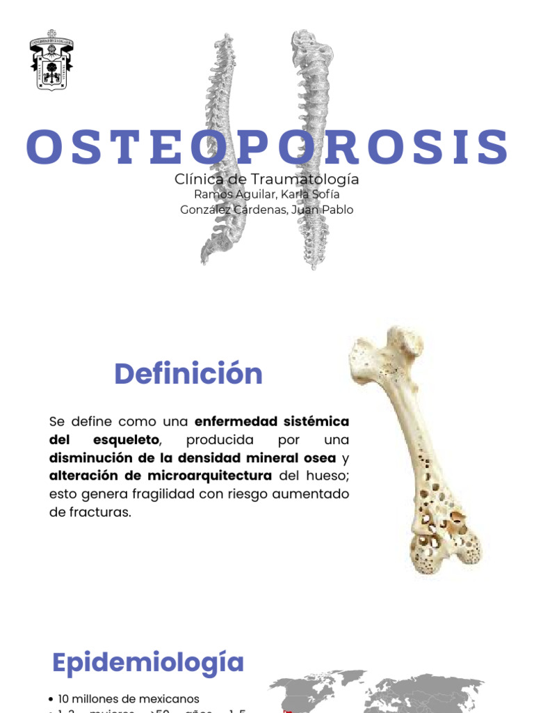 Guía Completa sobre Osteoporosis y Tratamiento | PDF | Osteoporosis ...