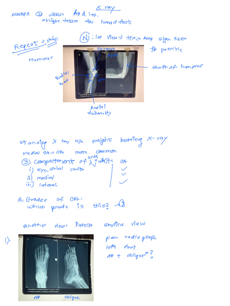 X Rays | PDF