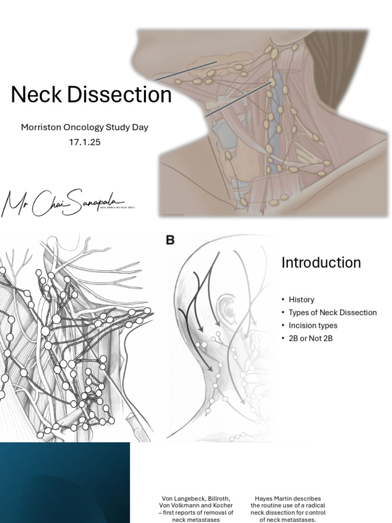 Neck Dissection Oncology Presentation | PDF | Cancer | Neck