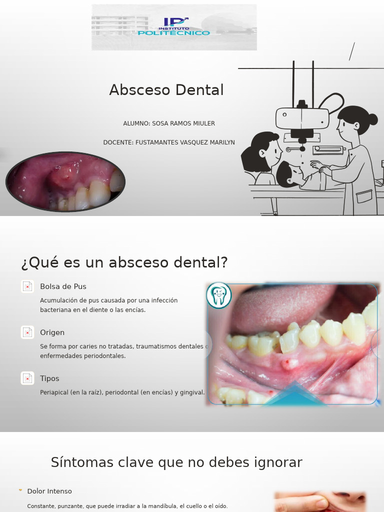 Absceso Dental | PDF | Odontología | Enfermedades y trastornos