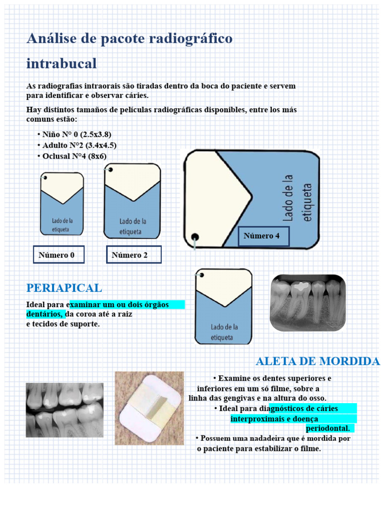 Tipos de Radiografias Intraorais Dentárias | PDF | Dente humano ...
