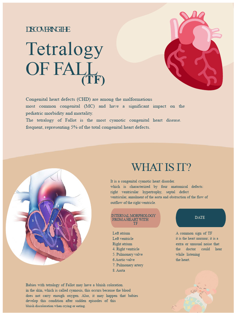 Infographic Tetralogy of Fallot | PDF