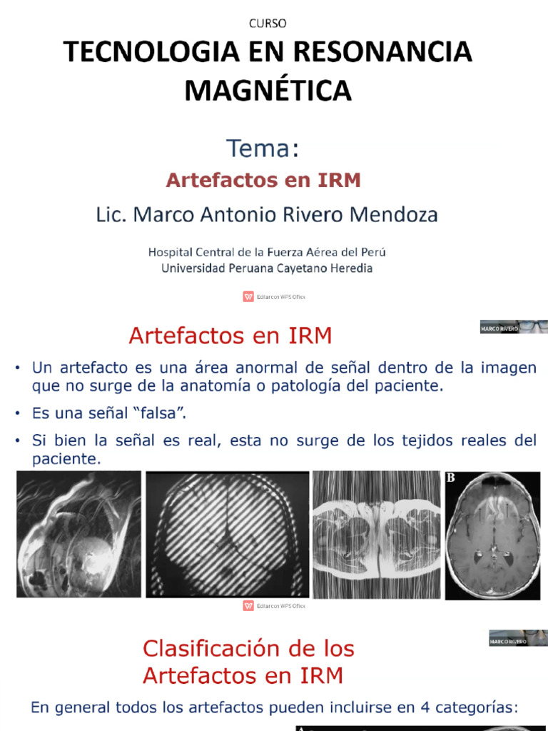RA7-I Artefactos en RMN | PDF