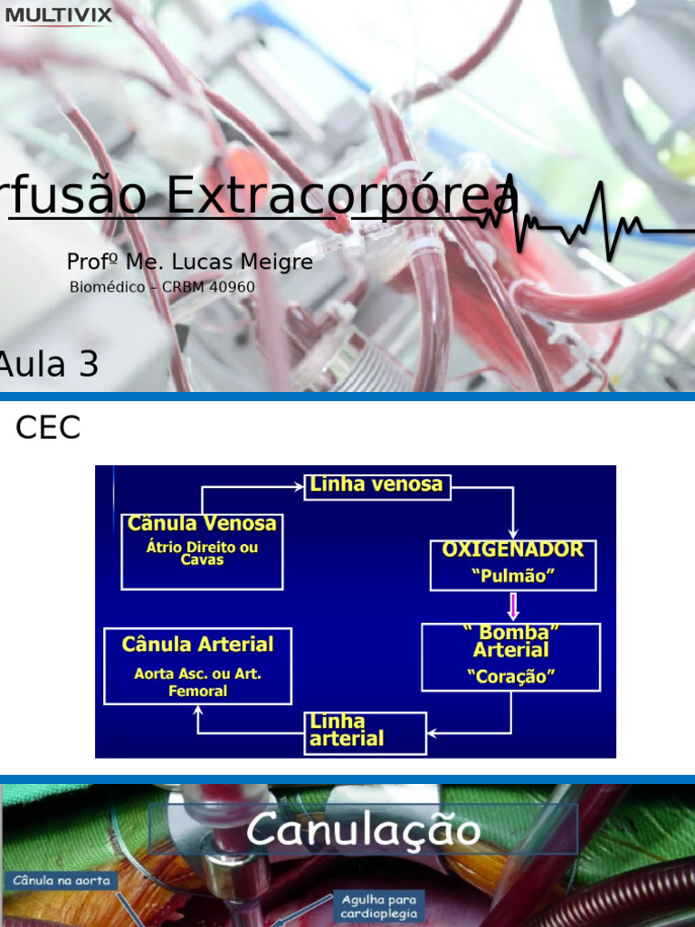 Perfusão Extracorpórea: Oxigenadores e Controle | PDF | Sangue | Hipotermia