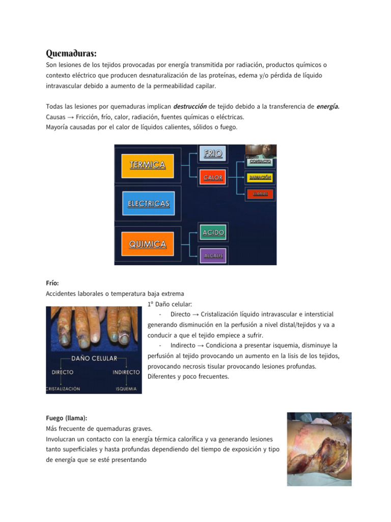 Causas y Manejo de Quemaduras | PDF | Quemar | Medicina CLINICA