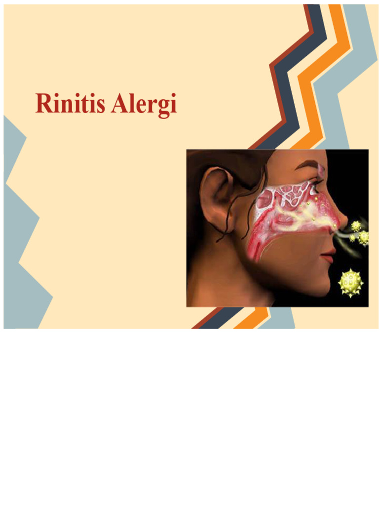 Panduan Lengkap Rinitis Alergi | PDF