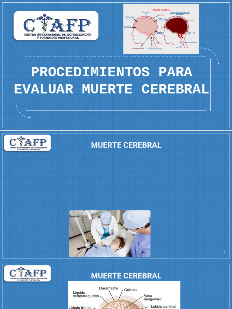 Evaluación de Muerte Cerebral: Procedimientos | PDF | Cerebro | Muerte