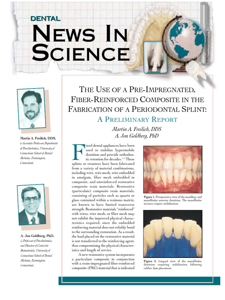 Fiber-Reinforced Composite for Dental Splints | PDF | Composite ...