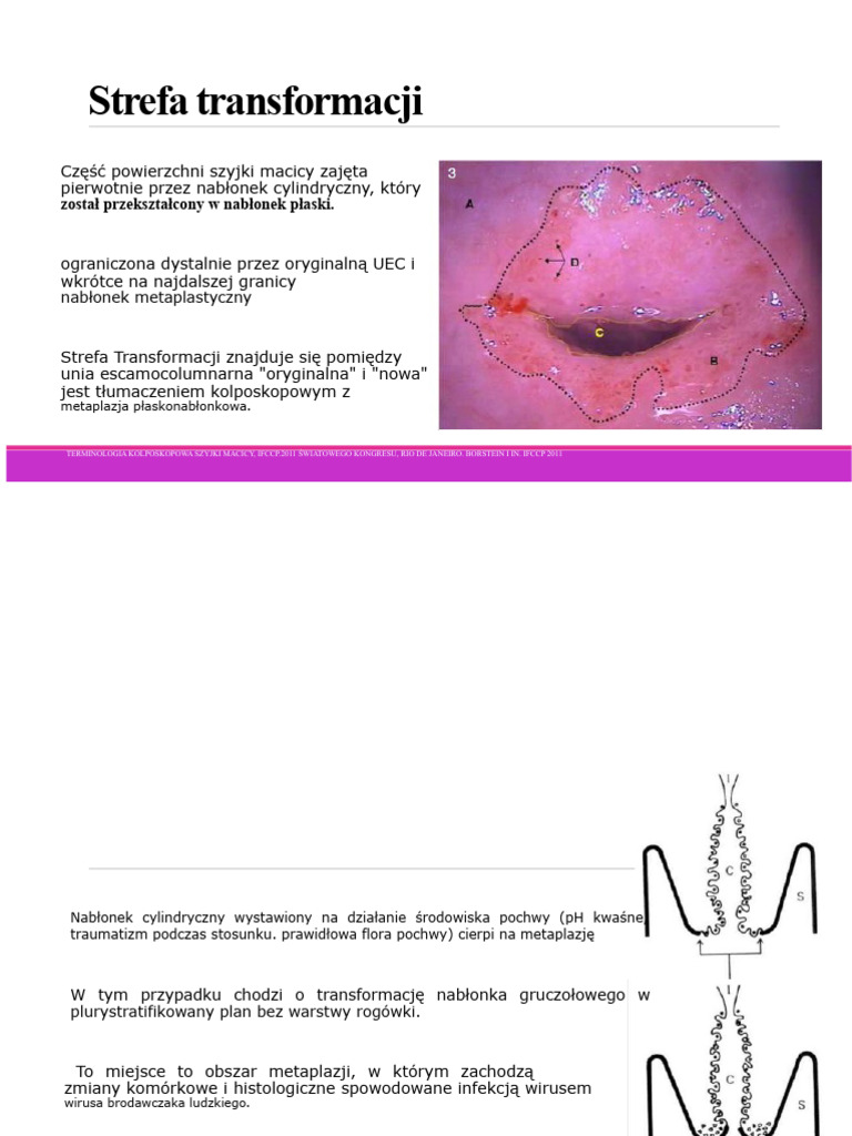 Strefa Transformacji | PDF