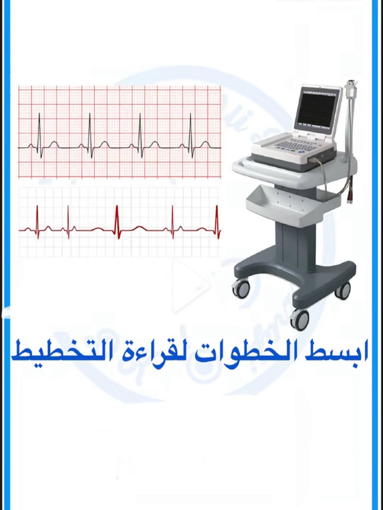 Ecg | PDF