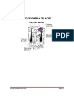 Etiopatogenia Del Acne 2