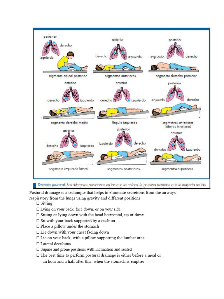 Postural drainage is a technique that helps to eliminate the | PDF