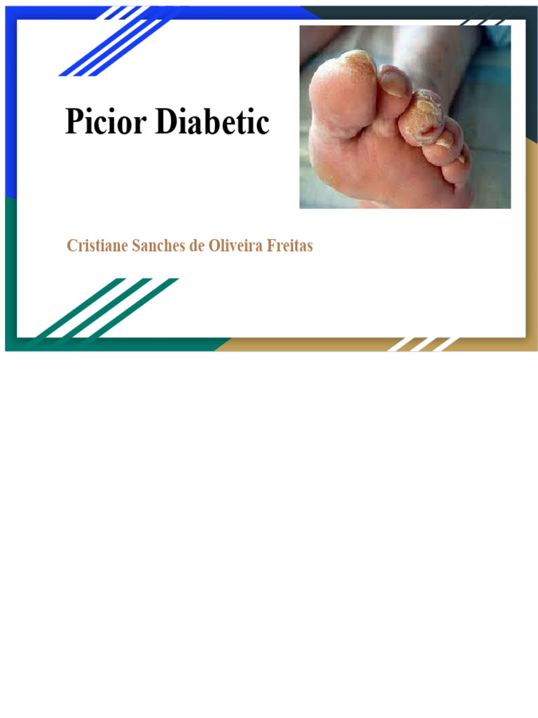 Picior Diabetic | PDF