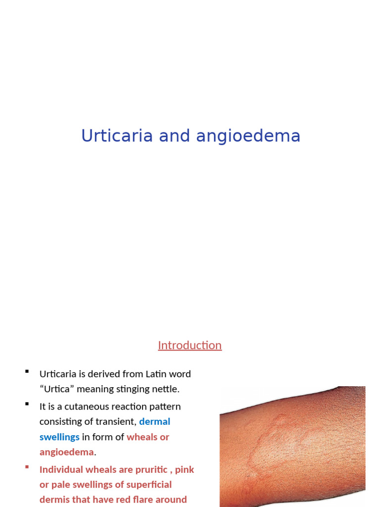 Urticaria and Angioedema Overview | PDF | Cutaneous Conditions ...