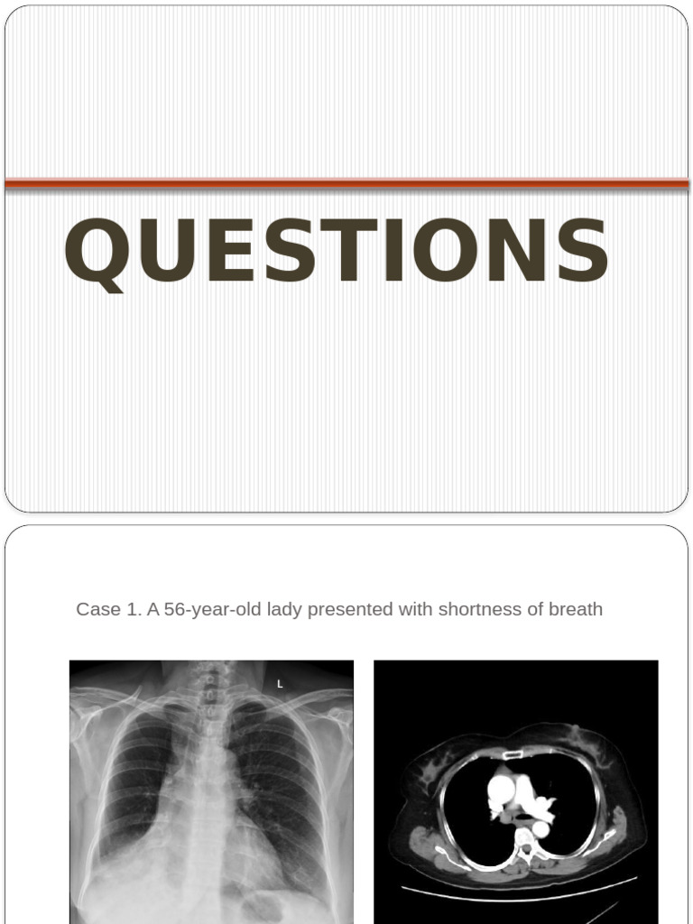 Chest QUIZ - Questions and Answers - Final | PDF