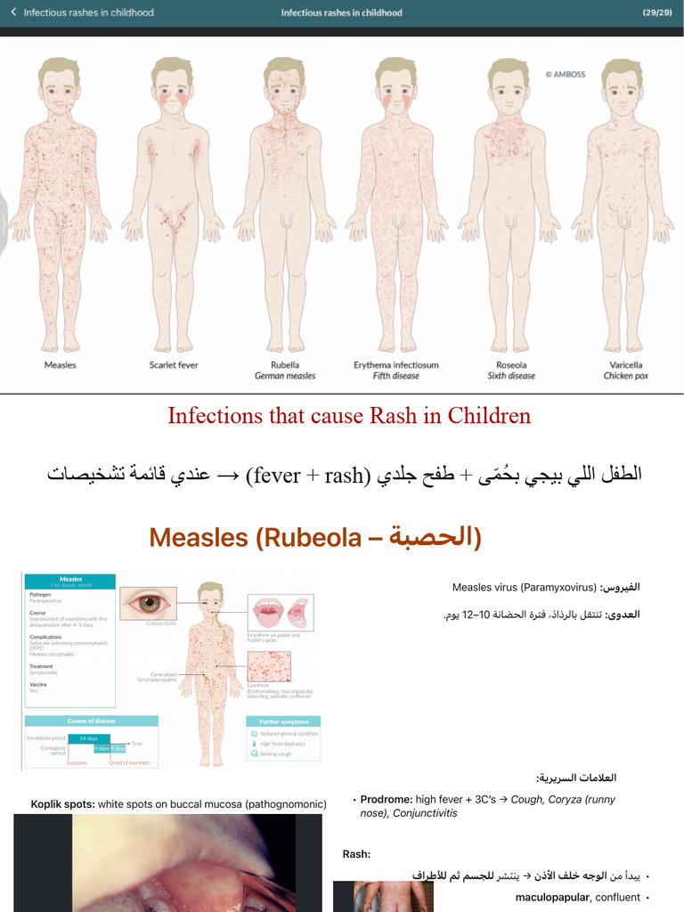 Rash-Causing Infections in Children | PDF | Measles | Streptococcus