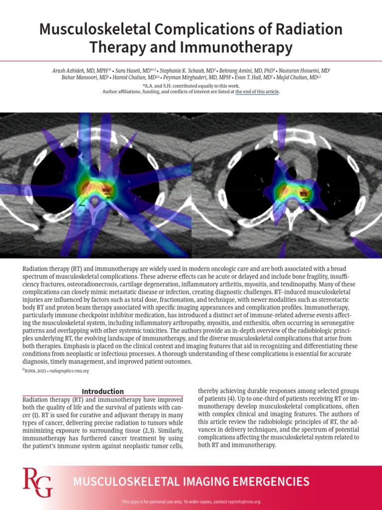 Musculoskeletal Complications of RT and Immunotherapy | PDF | Radiation ...