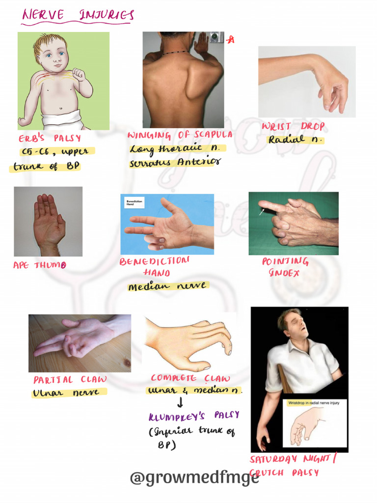150 Most Important Topics Updated | PDF
