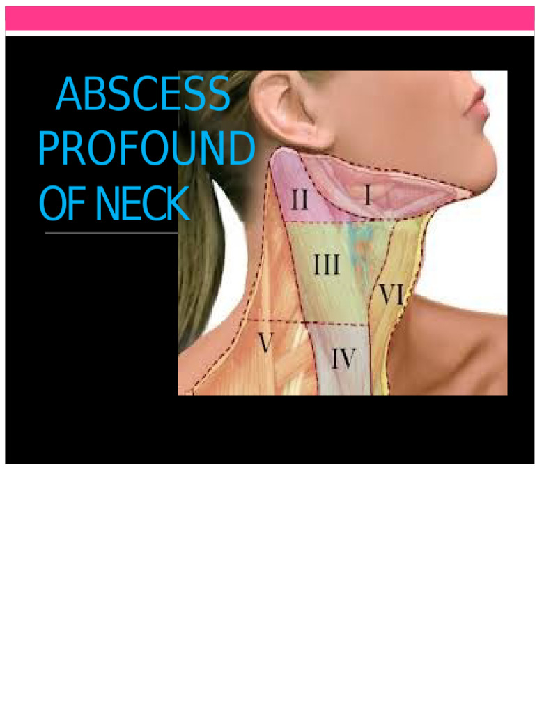 Carmen Deep Neck Abscess.. | PDF | Neck | Medical Specialties