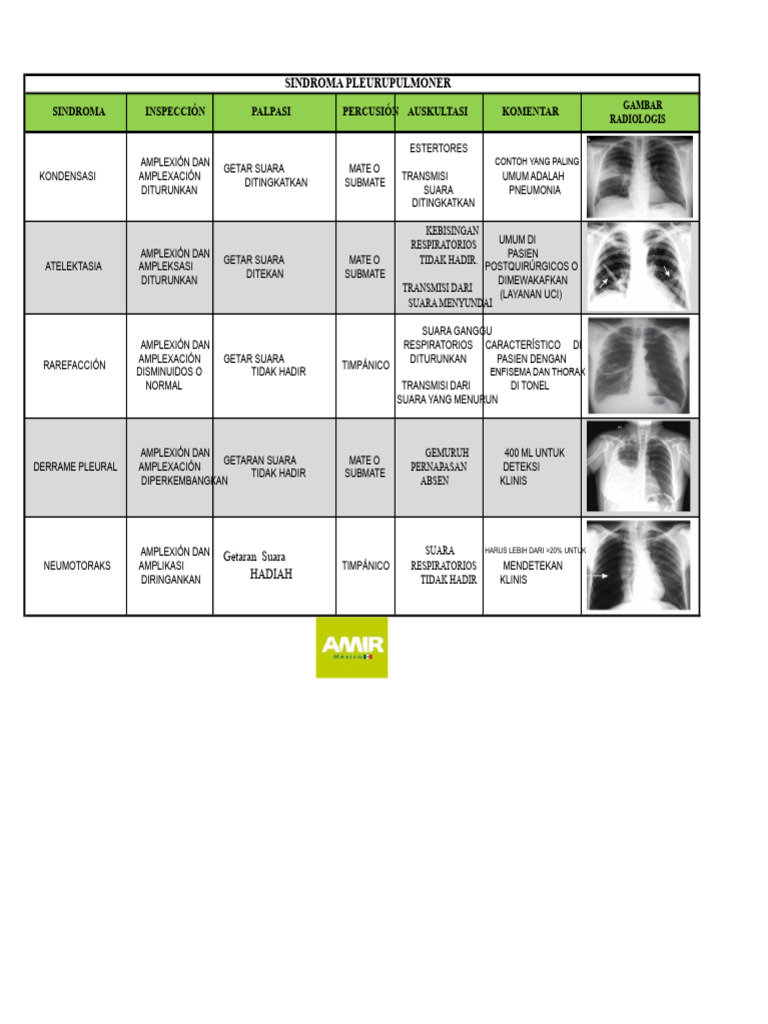 Diagnosa Sindroma Pleurupulmoner | PDF