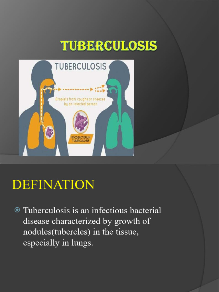 Tuberculosis Seminar | PDF | Tuberculosis | Medical Specialties