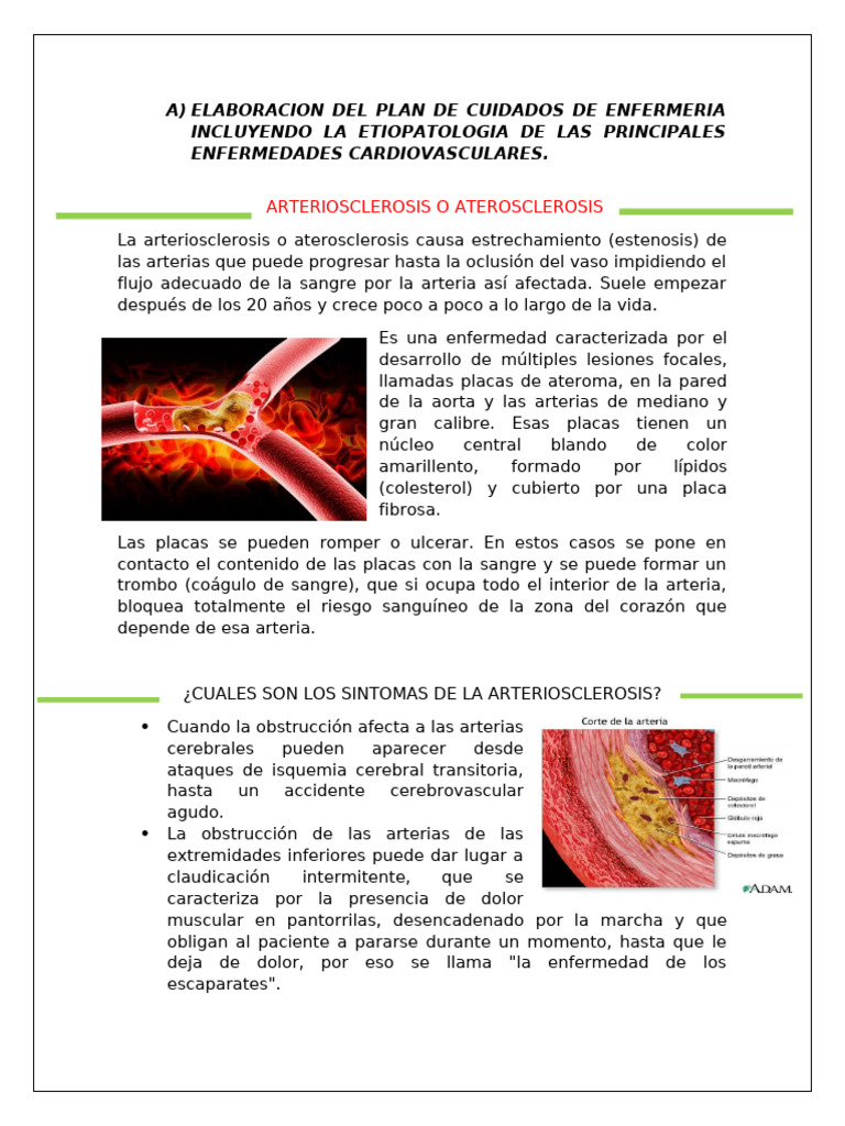 Plan de Cuidados en Enfermedades Cardiovasculares | PDF | Infarto de ...