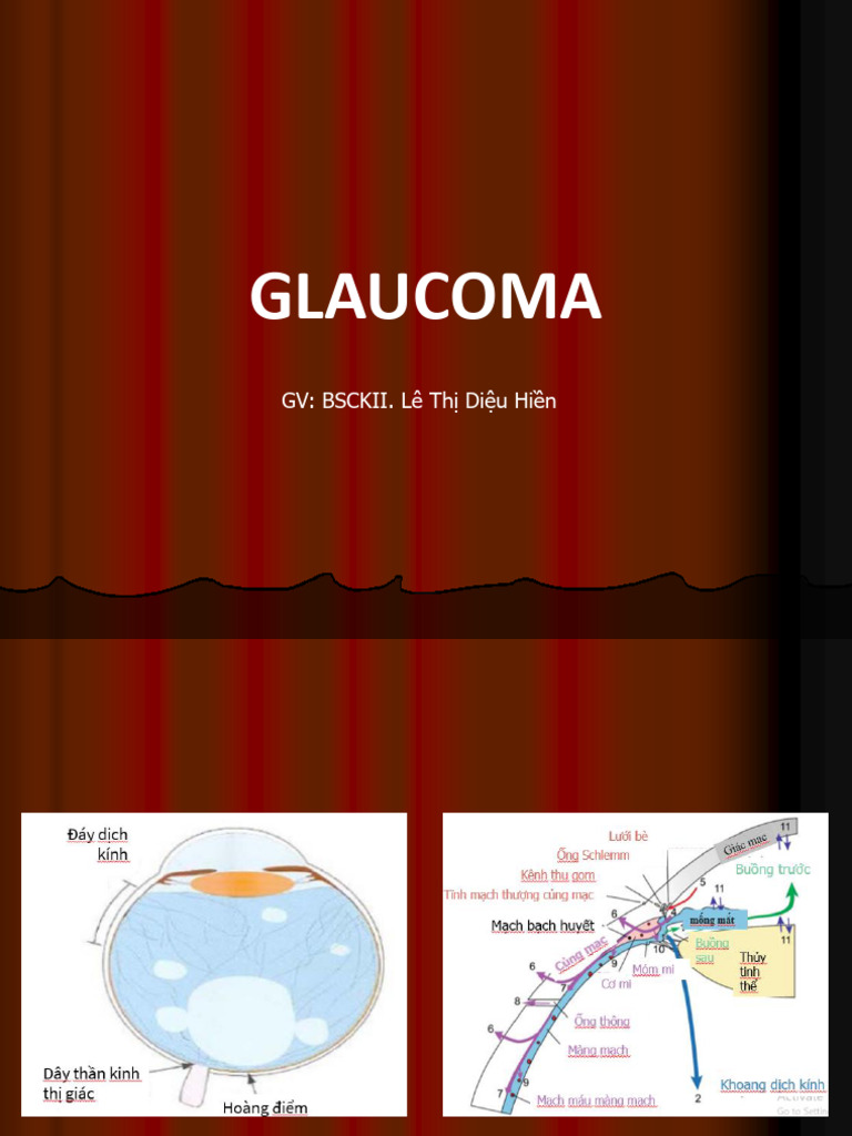 3.2. Glaucoma Final | PDF