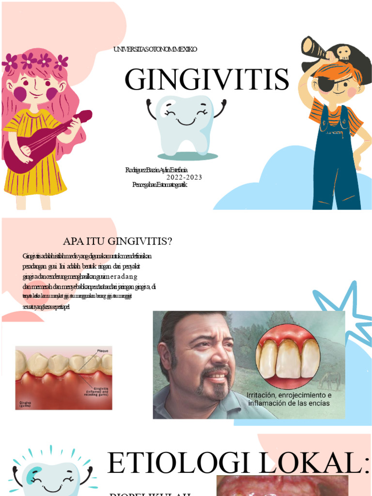 Gingivitis | PDF