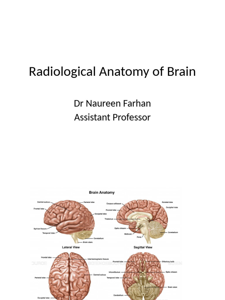 Brain Radiological Anatomy Guide | PDF