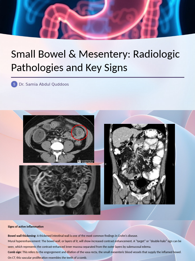 Radiologic Signs of Small Bowel Diseases | PDF | Gastrointestinal Tract ...