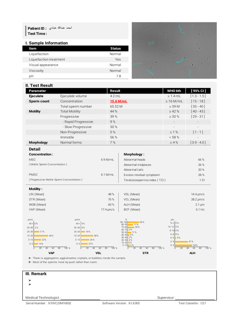 Sperm Analysis Report Summary | PDF | Body Fluids | Andrology