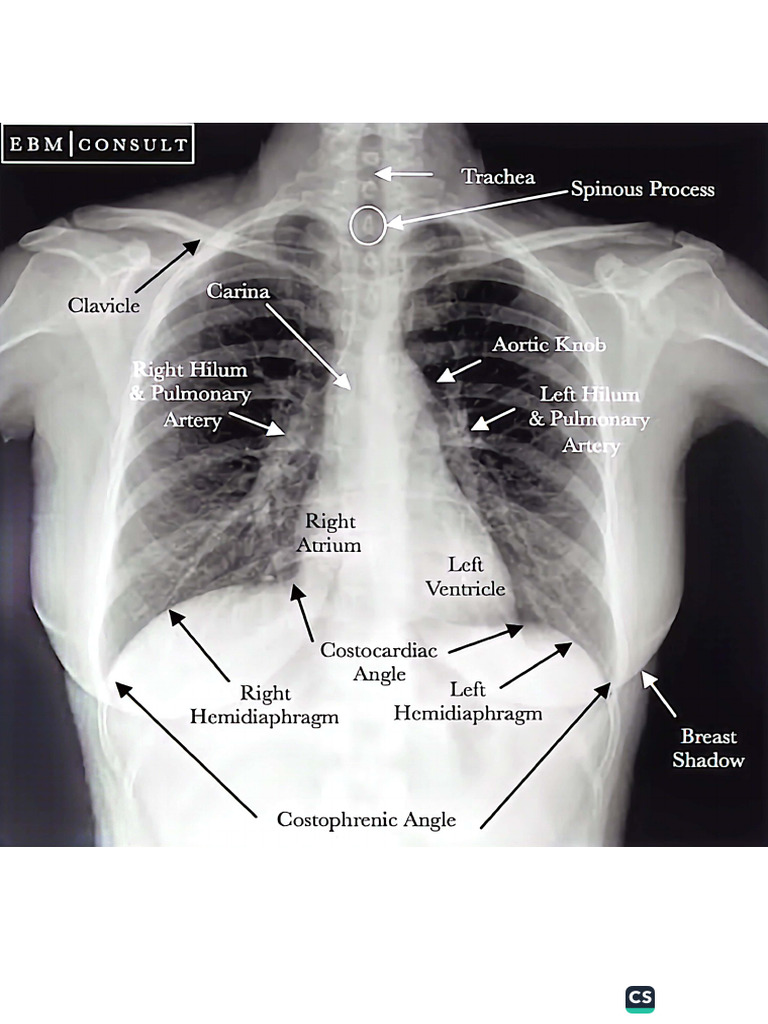 Thorax Radiographs | PDF