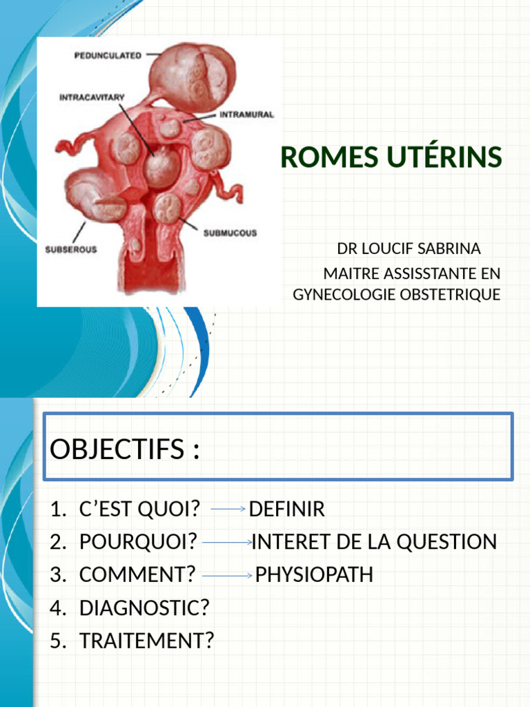 Fibromes utérins : diagnostic et traitement | PDF | Médecine clinique ...