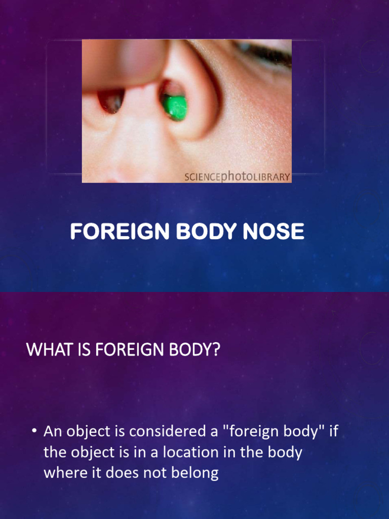 foreign body nose | PDF | Human Nose | Medical Specialties