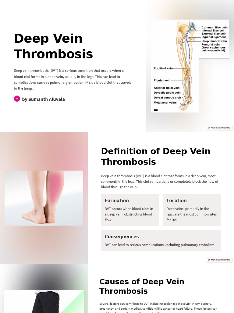 Understanding Deep Vein Thrombosis (DVT) | PDF | Thrombosis | Thrombus