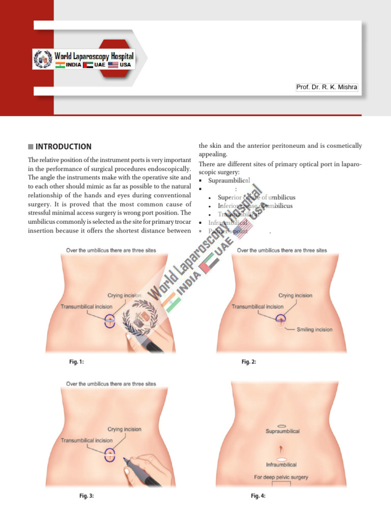 Laparoscopic Port Positioning Guide | PDF | Medical Procedures ...