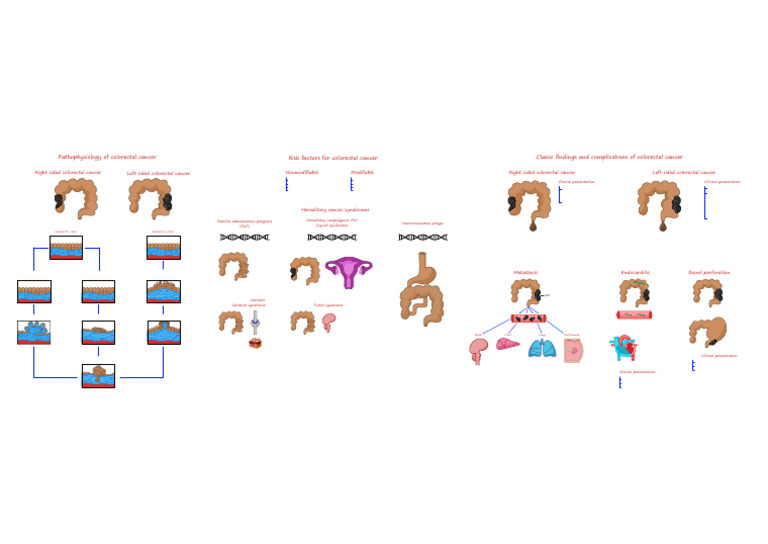 ONC 04 CRC (Illustrations Handout) | PDF | Colorectal Cancer | Neoplasms