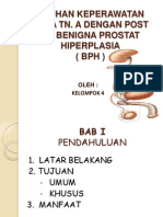 Benigna Prostat Hiperplasia