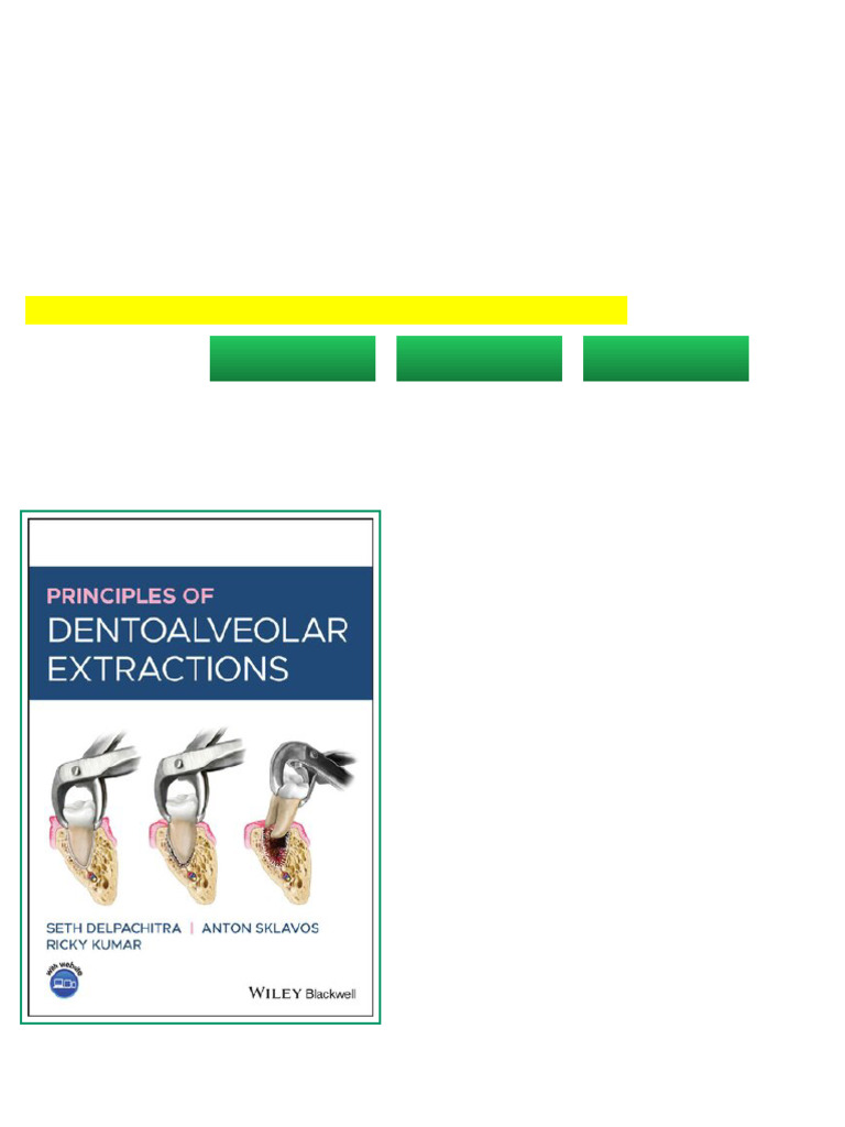 (Ebook) Principles of Dentoalveolar Extractions, Seth Delpachitra ...
