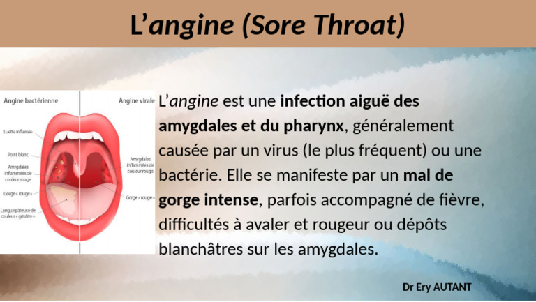 Angine : Symptômes et Causes | PDF