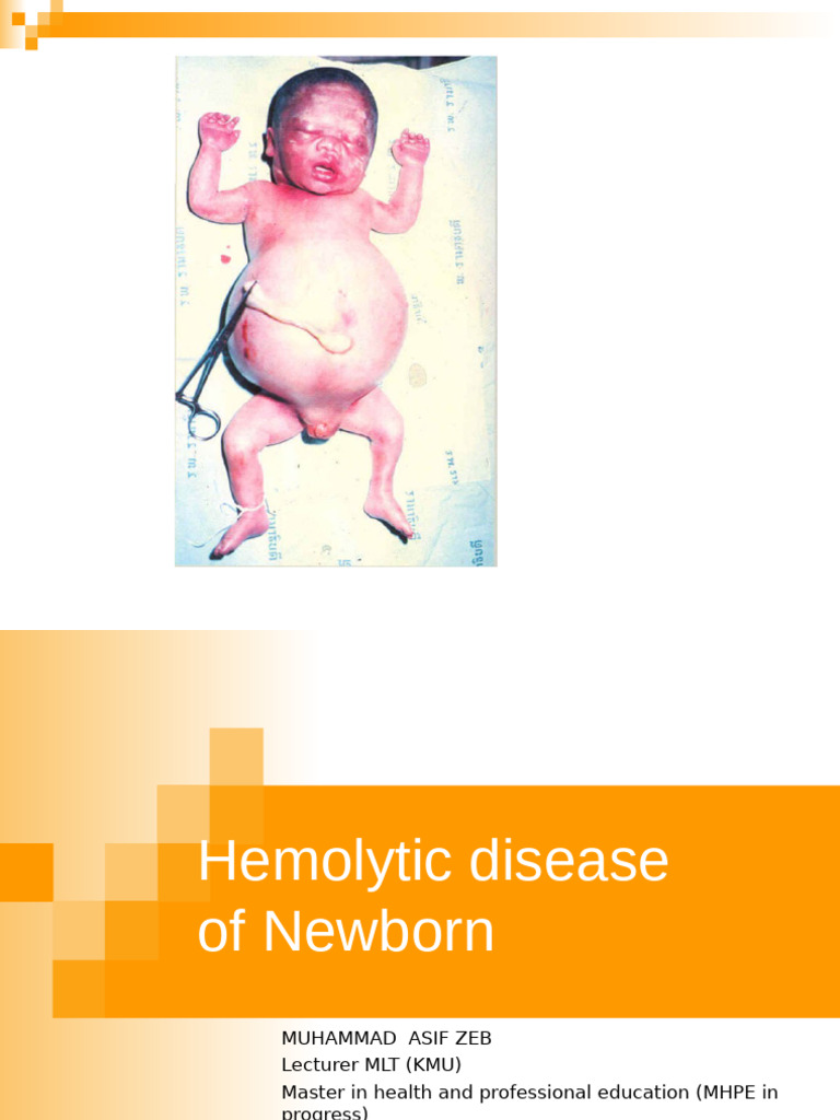 HDN for MLT..new-1 | PDF | Anatomy | Diseases And Disorders