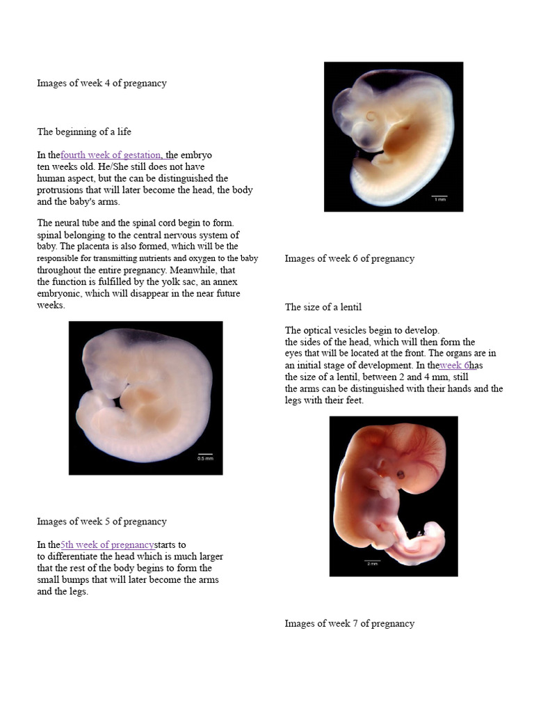 Images of week 4 of pregnancy | PDF | Brain | Pregnancy