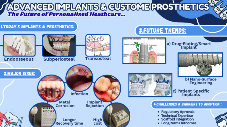 Future Trends in Advanced Implants | PDF