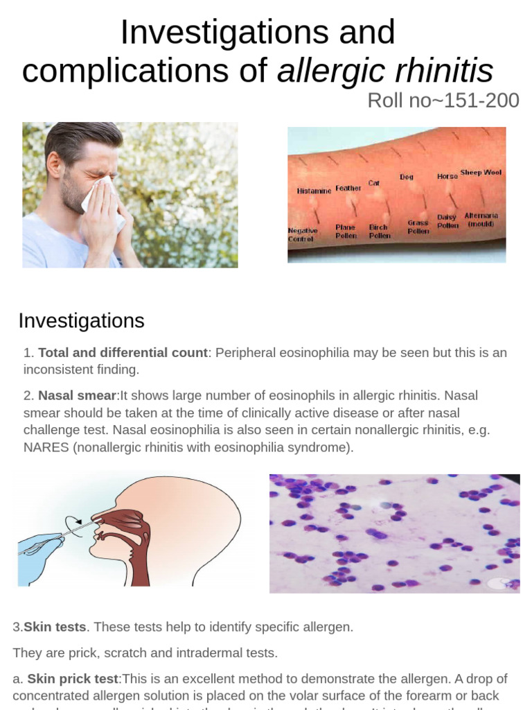 Allergic Rhinitis: Tests and Complications | PDF