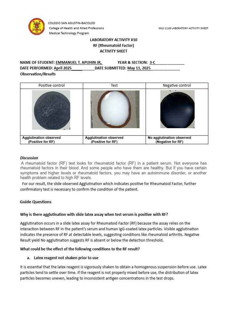 Rheumatoid Factor Test Lab Activity | PDF | Rheumatoid Arthritis ...