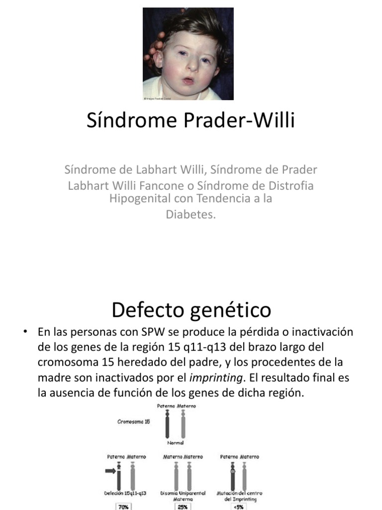 Síndrome Prader-Willi