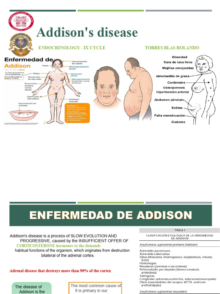 Addison's disease | PDF | Adrenal Gland | Endocrine System