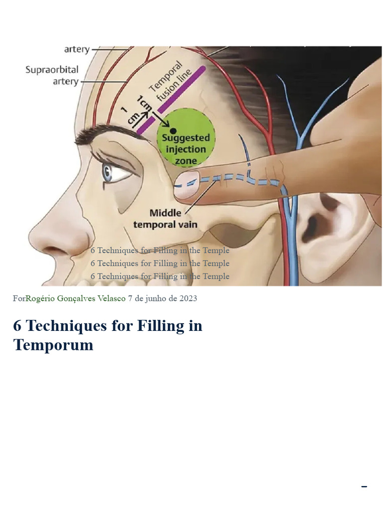 Temple Filling Techniques Explained | PDF | Vein | Human Anatomy
