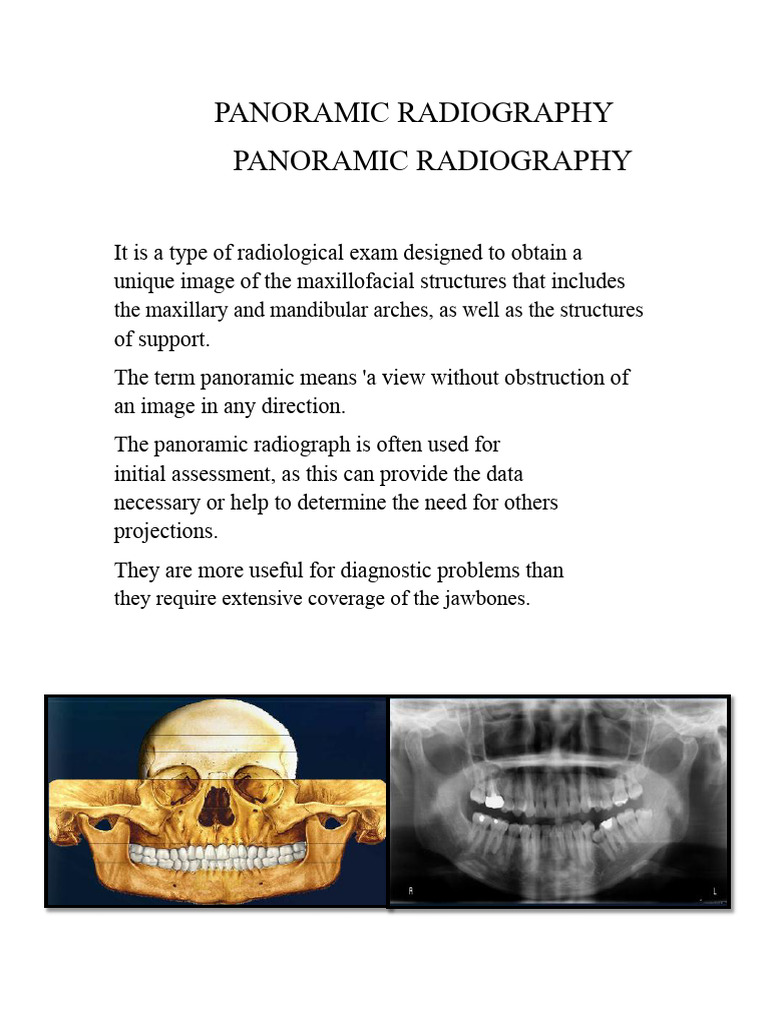 Panoramic Radiography Overview | PDF