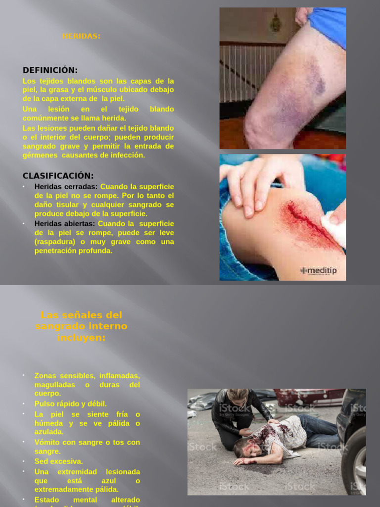 Guía de Manejo de Heridas y Quemaduras | PDF | Quemar | Herida